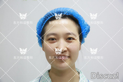 来自气质美女的自述：王自谦院长自带魔法棒-手臂吸脂多少钱找冯斌