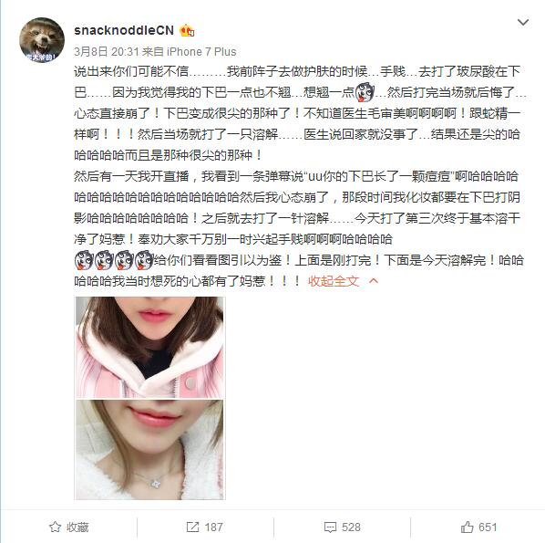 五五开女友爱美给自己打玻尿酸，结果下巴变尖差点成蛇精！-玻尿酸打了下巴变透明