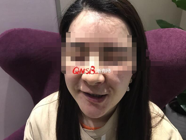 杭州三位爱美女士相约整形医院，花了39万结果都中毒了！-爱莱美玻尿酸怎么样