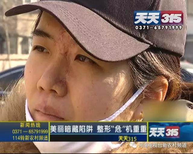 女子脸部血流不止送医后被诊神经坏死打进口瘦脸针费用多少