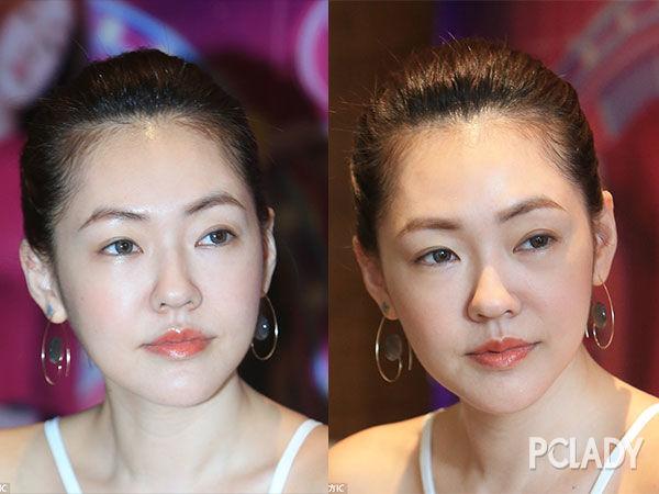 这真的是39岁吗？小S是喝玻尿酸的吧！-小孩可以使用玻尿酸吗多少钱