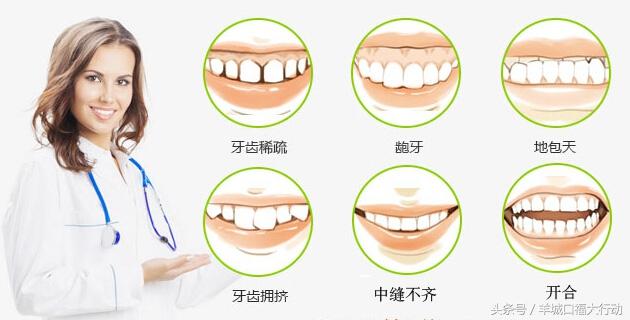 牙齿矫正费用多少钱？要多久？成年人可以吗？关于正畸手术的各类问题全面解答-箍牙矫正需要多少钱费用