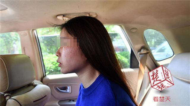 女子花万元做脸部填充手术，数月后面颊现肿块疼痛难忍-脂肪全面部填充多少钱