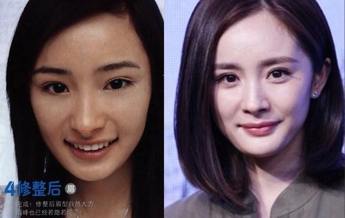 杨幂的鼻子是鼻综合吗，别追问杨幂削骨没