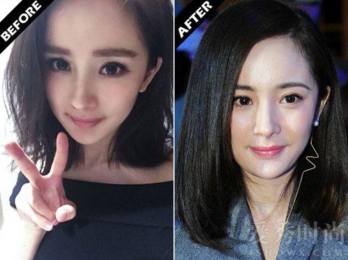 杨幂的鼻子是鼻综合吗，别追问杨幂削骨没