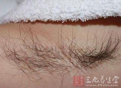 肩周肥胖(肩胖是什么原因)