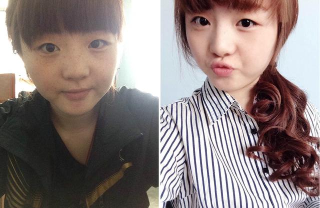 如何正确使用生姜祛斑，小小生姜这样用