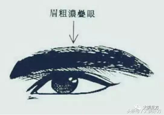 于朦胧整容史，堪称仙美的三生三世四哥于朦胧曾被孤立