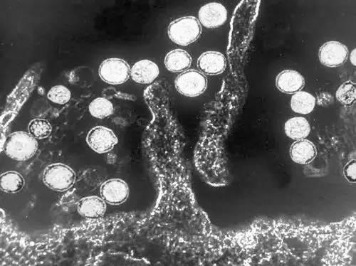 最容易隐藏的病毒，世界致命病毒大盘点