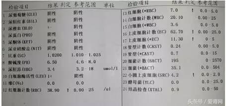 尿常规检查结果怎么看，尿常规报告怎么看结果