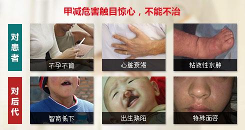 甲减早期脖子图片，甲减哪种症状就严重了（身体乏力、体力不支、畏寒怕冷）