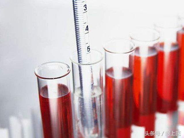 尿检结果怎么看，如何看懂尿检报告（尿常规的检查报告怎么解读）