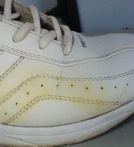 鞋子发黄了怎么办小妙招，鞋子发黄了怎么处理