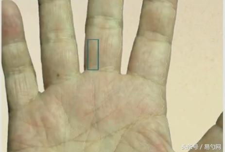手掌发青的图片，手掌又黄又青是什么原因