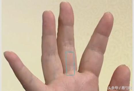 手掌发青的图片，手掌又黄又青是什么原因