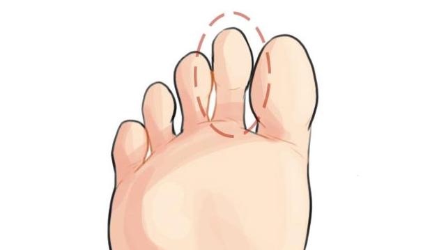 脚趾的长度代表什么，你是什么脚，就有什么命