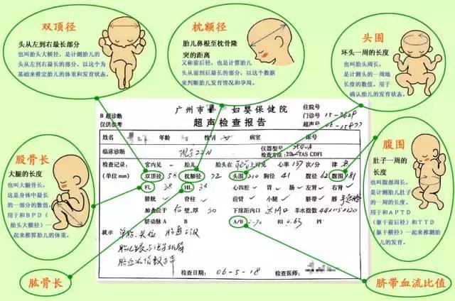 怀孕报告单图片，一分钟读懂孕9月产检报告单（产检报告像天书）