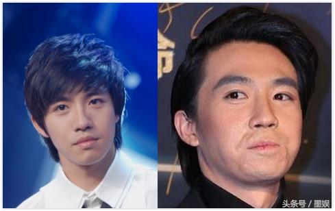 任家萱烧伤前后对比照，任家萱selina烧伤后的腿（手臂烧伤疤痕曝光太让人心疼）