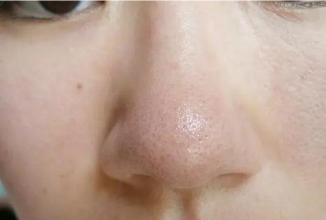 怎样去黑头和收缩毛孔，怎样正确去黑头缩小毛孔（几个简单小方法）