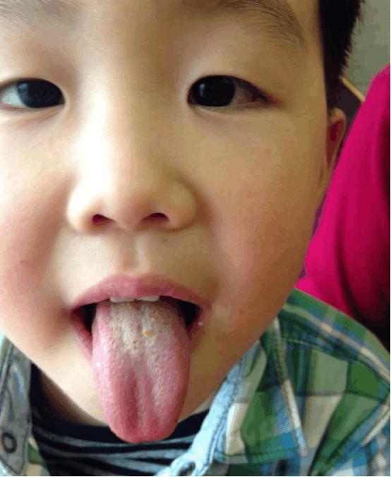 湿毒有哪些症状，体内湿毒会出现什么症状