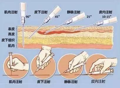 护士正确打针是怎么打的，平常看病打针，可是你知道吗
