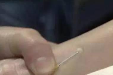 护士正确打针是怎么打的，平常看病打针，可是你知道吗
