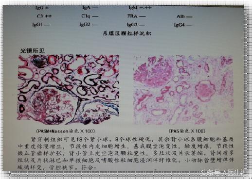 糖尿病与猪膀(糖尿病猪脚)