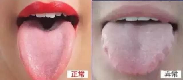 去湿热最好的方法，祛除体内湿热有3大诀窍（教你两味药黄金搭配）