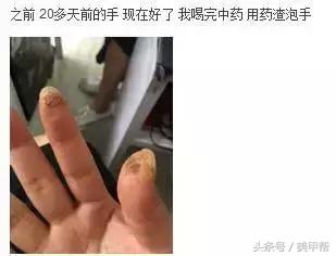 卸延长甲怎么收费，延长甲可以维持多久
