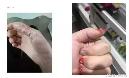 卸延长甲怎么收费，延长甲可以维持多久