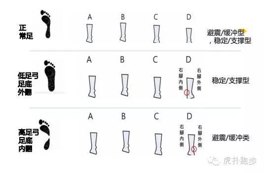 跑步脚型和选鞋，一般跑步穿什么运动鞋
