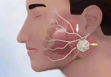 右眼皮一直跳是怎么回事，最近一直右眼皮跳预示着什么（“左眼跳财，右眼跳灾”是真的）