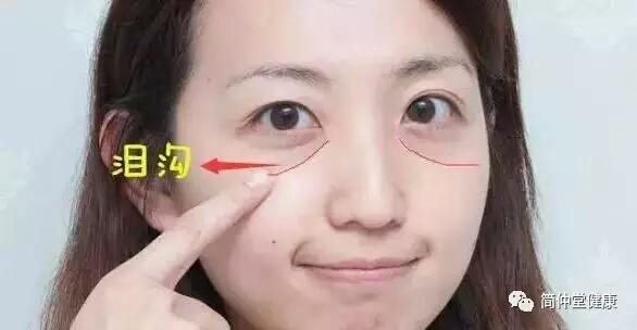 泪沟如何自己消除，自己如何消除泪沟