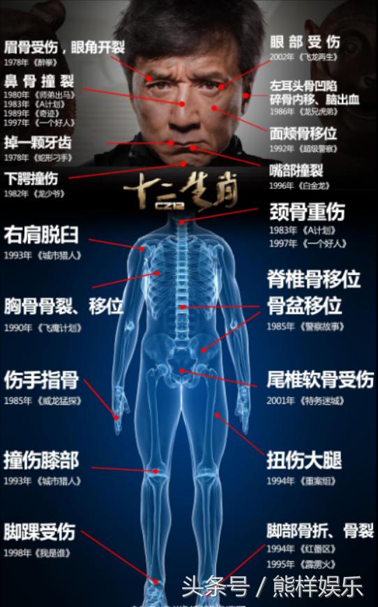 成龙全身受伤图，成龙大哥最好看电影