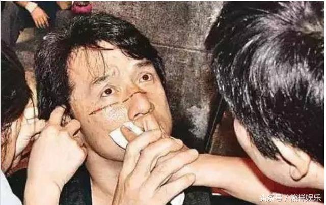 成龙全身受伤图，成龙大哥最好看电影