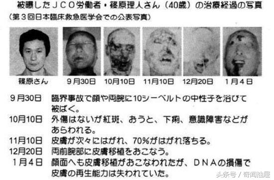 核辐射对人的伤害，核辐射对人类的危害有多大