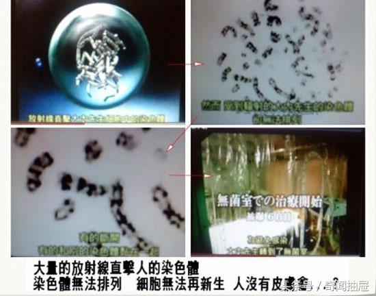 核辐射对人的伤害，核辐射对人类的危害有多大