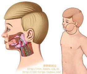 流行性腮腺炎的主要症状是什么，小儿流行性腮腺炎有什么症状