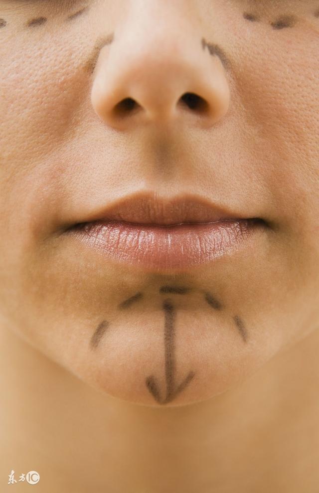 什么叫隆鼻，关于隆鼻最详细的介绍