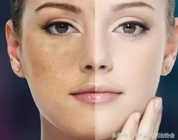 皮肤暗黄可能是什么原因，皮肤暗黄的原因你了解多少呢