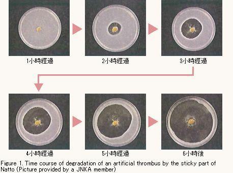 日本纳豆的功效与作用，日本纳豆的功效与作用一天吃多少（纳豆吃多了，还有这3个后果）
