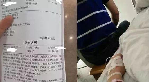 世界上第一位换头手术，捷报：人类首例换头手术成功