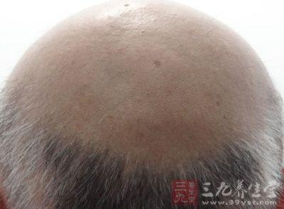 牛胆治糖尿病(牛苦胆治糖尿病)