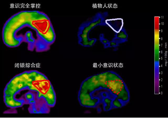 孤独死是什么意思，死亡困境死