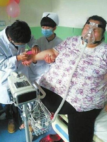 过偿性肥胖(过劳型肥胖)