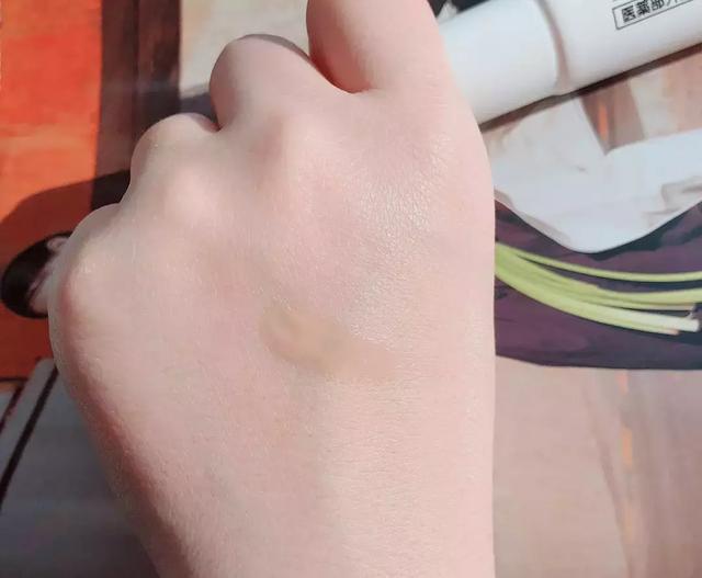 脂肪粒可以挤掉吗，脂肪粒可以手动挤出吗（小心与HPV病毒相关）