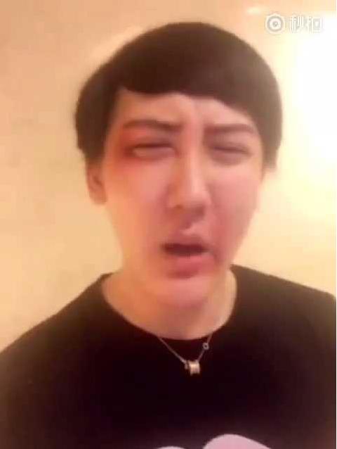 最丑富二代蛇精男西紅士，西紅士又出來“作妖”了