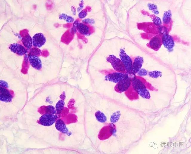 病理解剖学的四个方面，医学技术类专业全息解读