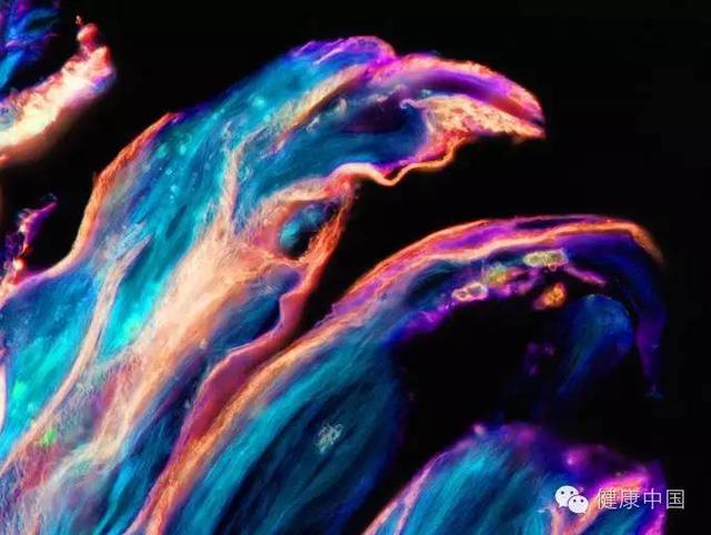 病理解剖学的四个方面，医学技术类专业全息解读