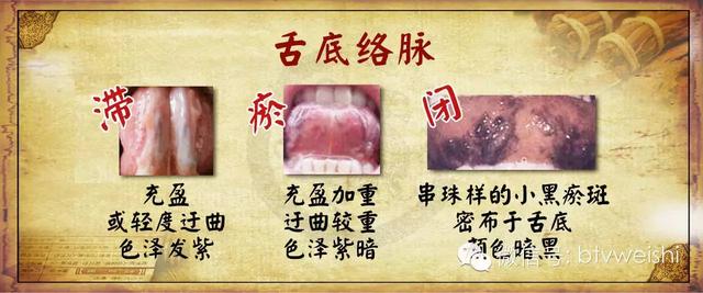 古方糖尿病(古方治糖尿病)